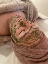 ビズエー(viz.A)/ハーブピーリング