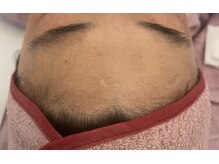 リフティングラボ(LIFTING LAB)/フェイシャルワックス