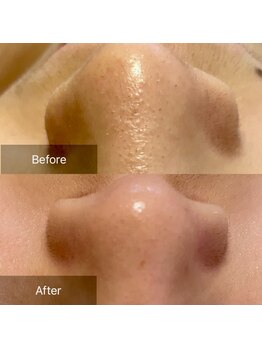 オンリーユータイム(ONLY YOU TIME)/角質ケア