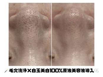 エステティック ボア(ESTHETIQUE BOITE)