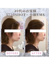 ラ セラフィータ 中目黒/【上級小顔】EMS美容液導入付き