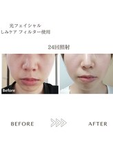 サロン エイトミー(salon 83)/【ハイドロジェリーマスク】