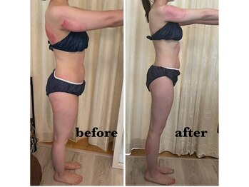 エステルーム パチュリー