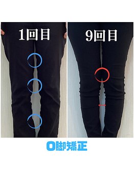 みくる整骨院/整体・骨盤調整/O脚矯正/肩こり