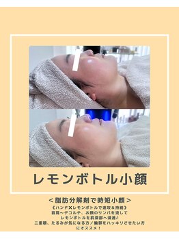 ソワナ(soina)/【神楽坂駅/フェイシャル/毛穴】