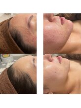 ナチュレ(Nature)/脂性肌でも剥離なしで艶肌に