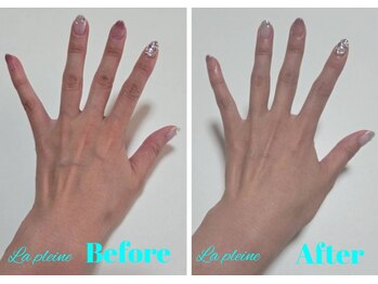 ラプレーヌ(La pleine)/ハンドケア＆アームマッサージ