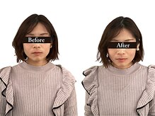 整体と美容鍼 無名/Before＆After【心斎橋/南船場】