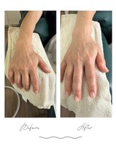 てみらい/ビフォーアフター