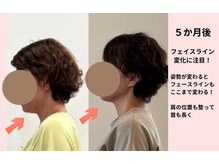 ビライン(Beline)/お客様の変化【01-2】