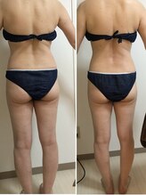 ミューズスタイル(muse style)/インキュア