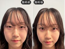 アオヤマ サロン ワイゼット(AOYAMA SALON YZ)/写真映え小顔へ