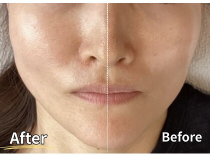 ナチュラルエイジングプラス(naturalaging+)の写真