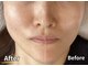 ナチュラルエイジングプラス(naturalaging+)の写真