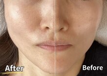 ナチュラルエイジングプラス(naturalaging+)