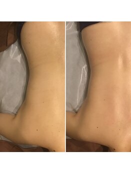 ファビリス 天王寺店(FAVILIS)/オーダーボディ1回/40代