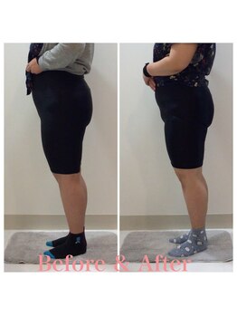 スタイルラボ高松/産後骨盤矯正の効果♪