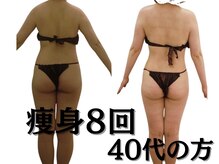 クリアー(clear)/痩身８回　４０代の方