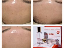 アンドカリス(Charis)/＆Charis韓国肌管理ララピール