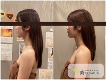 美プレミアム 越谷店/360°美顔小顔矯正｜施術結果