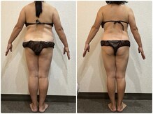 美容整体 ウェリナ 蟹江院/小顔矯正/骨盤矯正/美脚サロン