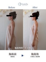 レムリア(Lemrlia)/