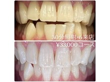 ホワイトニングルーム 横浜店(Whitening Room)/セルフホワイトニング/横浜