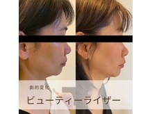 トータルビューティーサロンリア(Li'a)