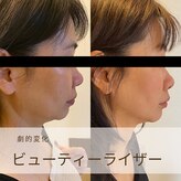 トータルビューティーサロンリア(Li'a)