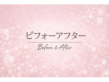 友愛はりきゅう美容整体院/美容鍼B/A