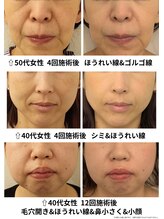 イーオ(io)/年代とお悩み別ビフォーアフター