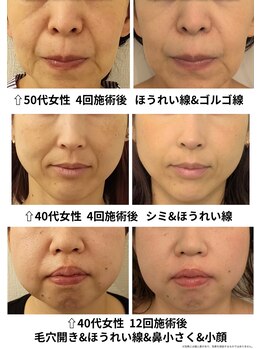 イーオ(io)/年代とお悩み別ビフォーアフター