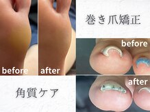 イーデザイン ネイル(E.design.Nail)