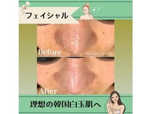 モット 広島店(Motto)の雰囲気（メニューが豊富！ボディーもフェイシャルもお任せください！）