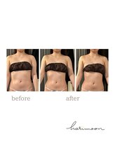 ハリムーン 仙台(harimoon)/美ボディコースビフォーアフター