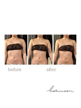 ハリムーン 仙台(harimoon)/美ボディコースビフォーアフター