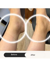 チューズコレクション(choose collection)/コリカンポ―ヒートジェル