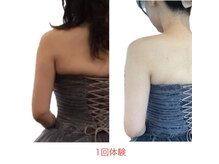 ジェーピーユキノ(jp.yukino)/二の腕・背中ハミ肉痩身