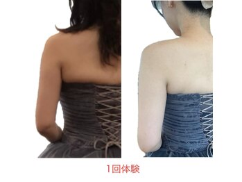 ジェーピーユキノ(jp.yukino)/二の腕・背中ハミ肉痩身