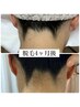 平日限定【夏こそ！後姿美人】うなじ&襟足脱毛シェービング付6600⇒4980/越谷