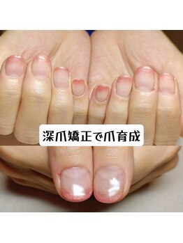 マニエネイル(mani e nail)/ナチュラルなネイルで深爪矯正
