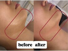 エン(O'en)/レッドショット