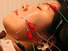 はりきゅうオレンジ