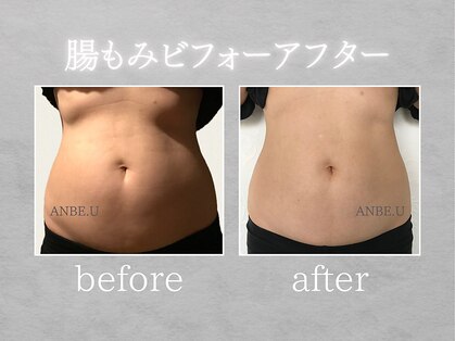 アンビーユー(ANBE.U)の写真