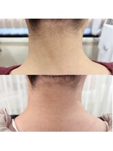 ヘアーデザイン レーゲンボーゲン(REGENBOGEN)/うなじwax