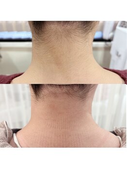 ヘアーデザイン レーゲンボーゲン(REGENBOGEN)/うなじwax