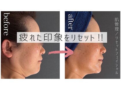ミーサ(Mysarest)の写真