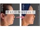 ミーサ(Mysarest)の写真