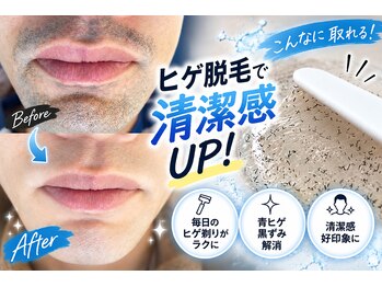 美痩身の写真/【脱毛/メンズ脱毛】第一印象は肌で変わる。全身脱毛で清潔感のある印象へ。ヒゲ・VIOまで対応♪