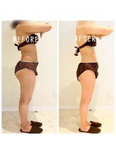 デジール(DESIR)/６カ月全身＆脚痩